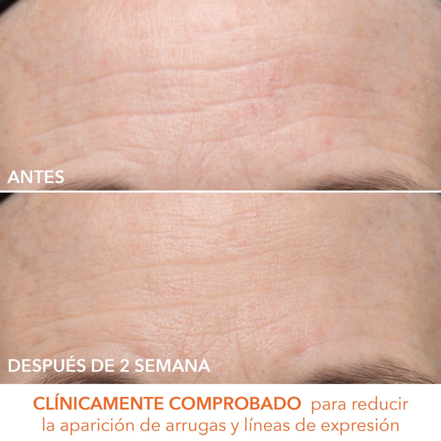 ALPHA BETA ULTRA GENTLE DAILY PEEL (ALMOHADILLAS EXFOLIANTES DIARIAS ULTRASUAVES PARA PIELES SENSIBLES)